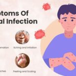 Top 10 Itraconazole Capsules Brands in India